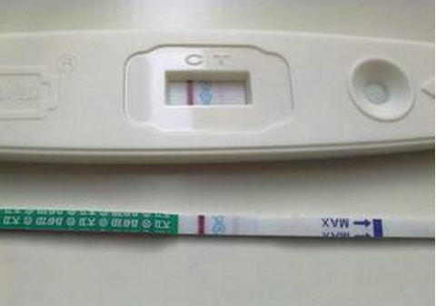 单基因病案例